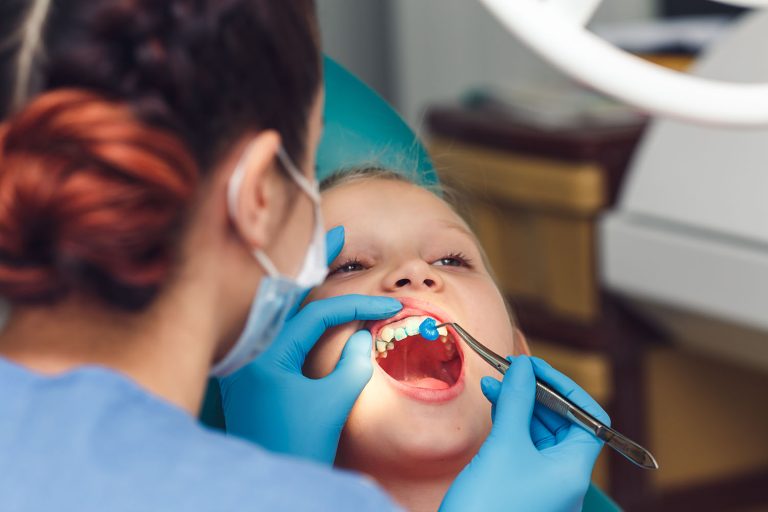 The Value Of Fluoride Varnish For Kids And Adults In Preventive Dentistry