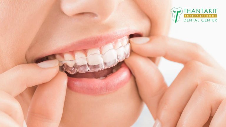 Why Tidal Aligners Focus On Patient Education